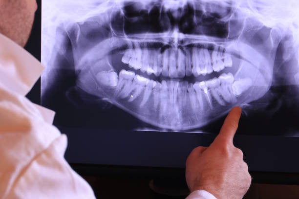 Best Holiday Emergency Dentist in Desnso, CA